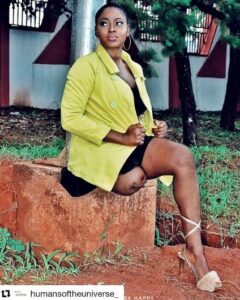 Lady with One Leg Shares Story of How She Became an Actress4.dailyfamily.ng